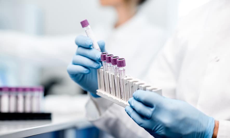 Insurance for biotech companies